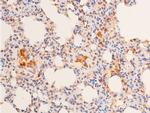 Phospho-p53 (Ser15) Antibody in Immunohistochemistry (Paraffin) (IHC (P))