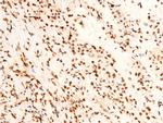 Phospho-c-Jun (Thr91) Antibody in Immunohistochemistry (Paraffin) (IHC (P))