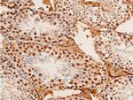 Phospho-c-Jun (Thr91) Antibody in Immunohistochemistry (Paraffin) (IHC (P))