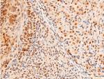 Phospho-c-Jun (Thr91) Antibody in Immunohistochemistry (Paraffin) (IHC (P))