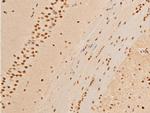 Phospho-c-Jun (Thr93) Antibody in Immunohistochemistry (Paraffin) (IHC (P))