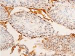 Phospho-c-Jun (Tyr170) Antibody in Immunohistochemistry (Paraffin) (IHC (P))