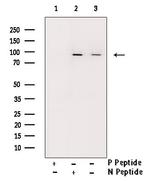 Phospho-INSR (Tyr1355) Antibody in Western Blot (WB)