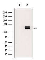 Phospho-LCK (Tyr394) Antibody in Western Blot (WB)