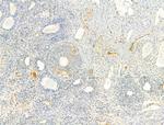 Phospho-Fyn (Tyr531) Antibody in Immunohistochemistry (Paraffin) (IHC (P))