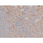 Phospho-Fyn (Tyr531) Antibody in Immunohistochemistry (Paraffin) (IHC (P))