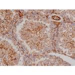 Phospho-Fyn (Tyr531) Antibody in Immunohistochemistry (Paraffin) (IHC (P))