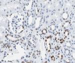 Phospho-Rb (Ser807) Antibody in Immunohistochemistry (Paraffin) (IHC (P))