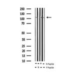 Phospho-Rb (Ser807) Antibody in Western Blot (WB)