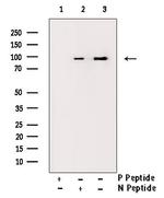 Phospho-Progesterone Receptor (Ser294) Antibody in Western Blot (WB)