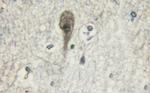 Phospho-beta-2 Adrenergic Receptor (Ser346) Antibody in Immunohistochemistry (Paraffin) (IHC (P))