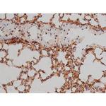 Phospho-SP1 (Thr453) Antibody in Immunohistochemistry (Paraffin) (IHC (P))