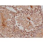 Phospho-SP1 (Thr453) Antibody in Immunohistochemistry (Paraffin) (IHC (P))