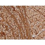 Phospho-SP1 (Thr453) Antibody in Immunohistochemistry (Paraffin) (IHC (P))