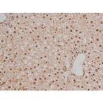 Phospho-SP1 (Thr453) Antibody in Immunohistochemistry (Paraffin) (IHC (P))