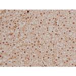 Phospho-SP1 (Thr453) Antibody in Immunohistochemistry (Paraffin) (IHC (P))