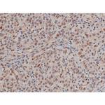 Phospho-SP1 (Thr453) Antibody in Immunohistochemistry (Paraffin) (IHC (P))