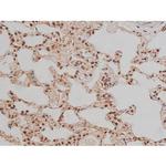 Phospho-SP1 (Thr453) Antibody in Immunohistochemistry (Paraffin) (IHC (P))