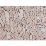 Phospho-SP1 (Thr453) Antibody in Immunohistochemistry (Paraffin) (IHC (P))