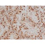 Phospho-SP1 (Thr453) Antibody in Immunohistochemistry (Paraffin) (IHC (P))