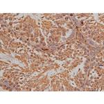 Phospho-SP1 (Thr739) Antibody in Immunohistochemistry (Paraffin) (IHC (P))