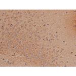 Phospho-SP1 (Thr739) Antibody in Immunohistochemistry (Paraffin) (IHC (P))