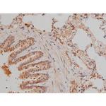 Phospho-SP1 (Thr739) Antibody in Immunohistochemistry (Paraffin) (IHC (P))