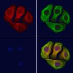 Phospho-IGF1R (Tyr1346) Antibody in Immunocytochemistry (ICC/IF)