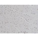 Phospho-IGF1R (Tyr1346) Antibody in Immunohistochemistry (Paraffin) (IHC (P))