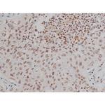 Phospho-IGF1R (Tyr1346) Antibody in Immunohistochemistry (Paraffin) (IHC (P))