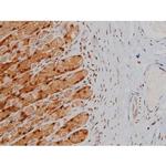 Phospho-IGF1R (Tyr1346) Antibody in Immunohistochemistry (Paraffin) (IHC (P))