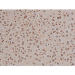 Phospho-IGF1R (Tyr1346) Antibody in Immunohistochemistry (Paraffin) (IHC (P))