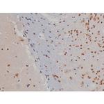 Phospho-IGF1R (Tyr1346) Antibody in Immunohistochemistry (Paraffin) (IHC (P))