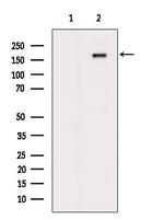 Phospho-IGF1R (Tyr1161) Antibody in Western Blot (WB)