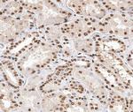 Phospho-Histone H2A (Thr121) Antibody in Immunohistochemistry (Paraffin) (IHC (P))