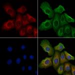 Phospho-FGFR1 (Tyr766) Antibody in Immunocytochemistry (ICC/IF)