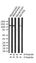 Phospho-FGFR1 (Tyr654) Antibody in Western Blot (WB)