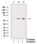 Phospho-VDR (Ser208) Antibody in Western Blot (WB)