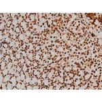 Phospho-Ezrin (Tyr354) Antibody in Immunohistochemistry (Paraffin) (IHC (P))