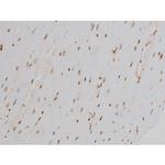 Phospho-Ezrin (Tyr478) Antibody in Immunohistochemistry (Paraffin) (IHC (P))