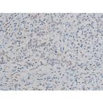 Phospho-ATF2 (Thr69, Thr51) Antibody in Immunohistochemistry (Paraffin) (IHC (P))