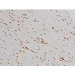 Phospho-ATF2 (Thr69, Thr51) Antibody in Immunohistochemistry (Paraffin) (IHC (P))