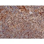 Phospho-ATF2 (Thr69, Thr51) Antibody in Immunohistochemistry (Paraffin) (IHC (P))