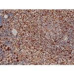 Phospho-ATF2 (Thr69, Thr51) Antibody in Immunohistochemistry (Paraffin) (IHC (P))