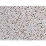 Phospho-ATF2 (Thr69, Thr51) Antibody in Immunohistochemistry (Paraffin) (IHC (P))