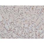 Phospho-ATF2 (Thr69, Thr51) Antibody in Immunohistochemistry (Paraffin) (IHC (P))