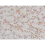 Phospho-ATF2 (Thr69, Thr51) Antibody in Immunohistochemistry (Paraffin) (IHC (P))