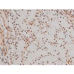 Phospho-ATF2 (Thr69, Thr51) Antibody in Immunohistochemistry (Paraffin) (IHC (P))