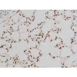 Phospho-ATF2 (Thr69, Thr51) Antibody in Immunohistochemistry (Paraffin) (IHC (P))