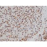 Phospho-ATF2 (Thr69, Thr51) Antibody in Immunohistochemistry (Paraffin) (IHC (P))